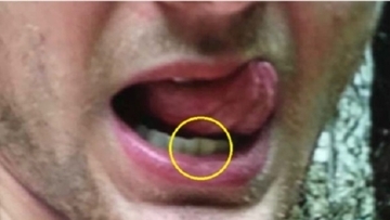 「歯がズレて死亡」米大生両親との面会拒否する文在寅の誤算