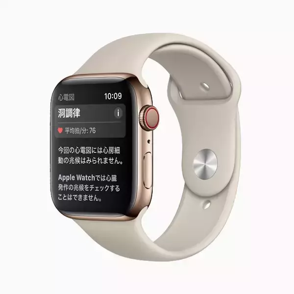 「Apple Watch、心電図アプリケーションと不規則な心拍の通知機能が利用可能に」の画像