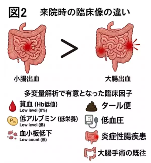 「【東京医科大学】小腸出血は大腸出血より輸血・手術・長期死亡リスクが高いことを解明 ～世界最大規模約1万例の急性下部消化管出血データ構築～」の画像