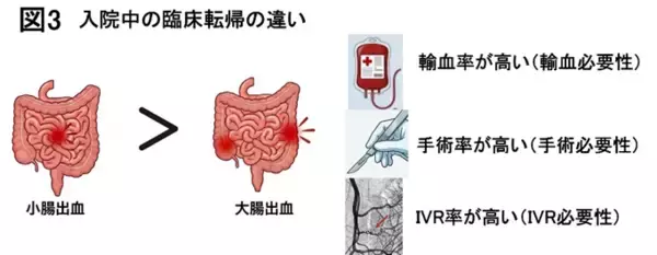 「【東京医科大学】小腸出血は大腸出血より輸血・手術・長期死亡リスクが高いことを解明 ～世界最大規模約1万例の急性下部消化管出血データ構築～」の画像