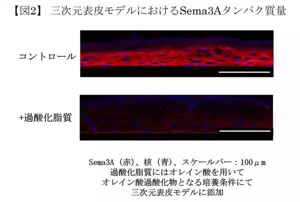 「皮脂の酸化が頭皮のかゆみの一因となるメカニズムを確認」の画像