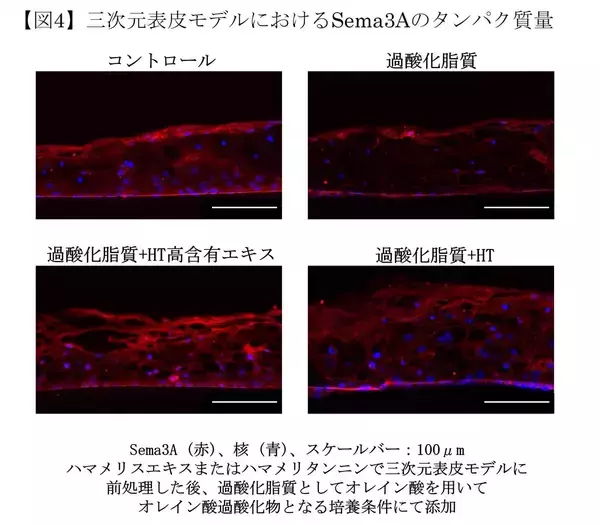 「皮脂の酸化が頭皮のかゆみの一因となるメカニズムを確認」の画像