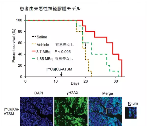 「【横浜市立大学】悪性脳腫瘍に対する“低酸素領域標的型”局所放射線治療の有効性を実証」の画像