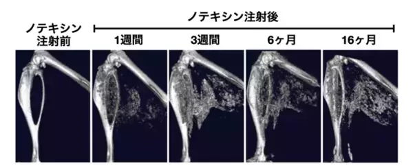 石灰化筋壊死症を再現する新規マウスモデルを確立