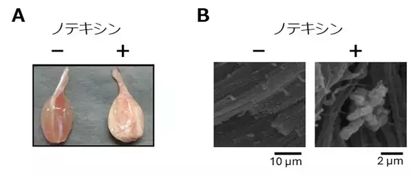 「石灰化筋壊死症を再現する新規マウスモデルを確立」の画像
