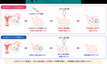 若年女性がん患者の卵巣機能を守るために～卵巣保護目的のGnRHアナログ製剤、普及への課題が明らかに～