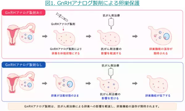 若年女性がん患者の卵巣機能を守るために～卵巣保護目的のGnRHアナログ製剤、普及への課題が明らかに～