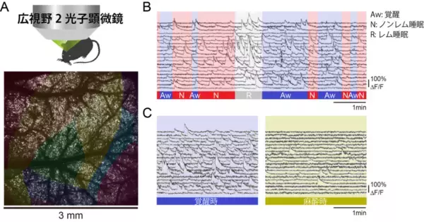 「【横浜市立大学】意識・無意識脳での神経のつながり方の可視化に成功」の画像