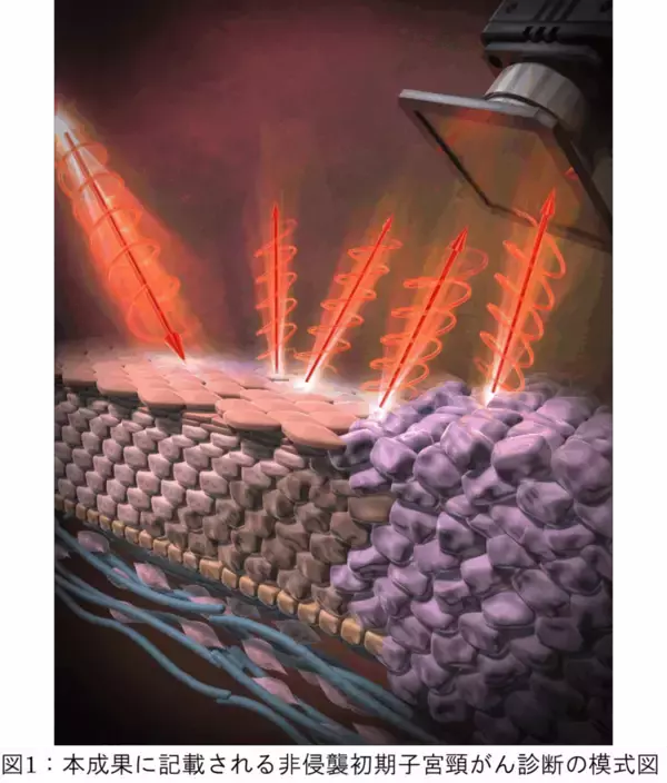 深部異形成を非侵襲に捉える円偏光散乱(CiPLS)イメージング ―子宮頸がん前駆病変の非侵襲診断に向けて―（北里大学）