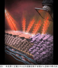 深部異形成を非侵襲に捉える円偏光散乱(CiPLS)イメージング ―子宮頸がん前駆病変の非侵襲診断に向けて―（北里大学）