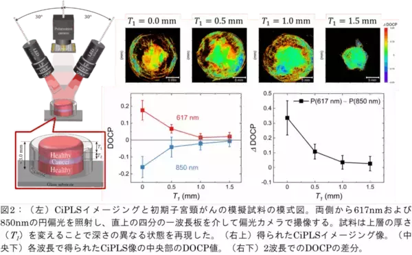 「深部異形成を非侵襲に捉える円偏光散乱(CiPLS)イメージング ―子宮頸がん前駆病変の非侵襲診断に向けて―（北里大学）」の画像