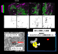【学習院大学・岡山理科大学・東京都健康長寿医療センター・金沢大学・東京大学】ミトコンドリアとメラノソームの接触がメラニン色素形成を制御−メラニン色素形成を支える細胞内機構を解明−