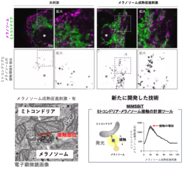 【学習院大学・岡山理科大学・東京都健康長寿医療センター・金沢大学・東京大学】ミトコンドリアとメラノソームの接触がメラニン色素形成を制御−メラニン色素形成を支える細胞内機構を解明−