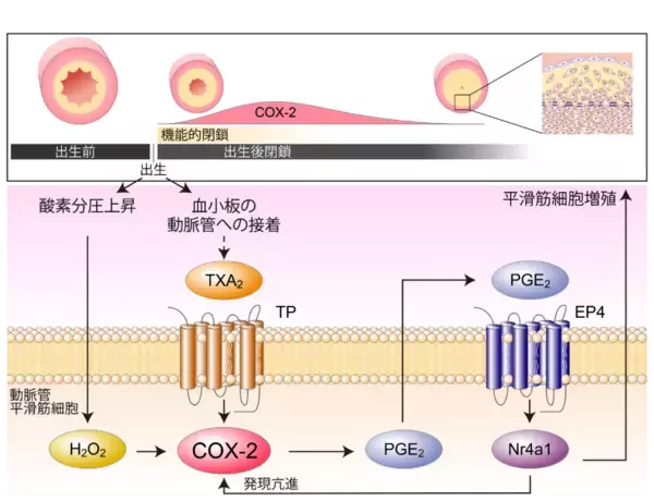 【横浜市立大学】動脈管開存症に対するシクロオキシゲナーゼ阻害薬の投与タイミングに新たな科学的根拠