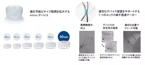 非弁膜症性心房細動による脳卒中を予防する最新世代「WATCHMAN FLX(TM) Pro 左心耳閉鎖システム」新発売