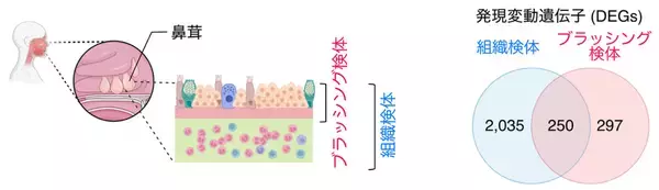 「低侵襲な「鼻のブラッシング」で好酸球性副鼻腔炎の病型分類に成功」の画像