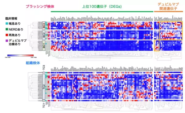 「低侵襲な「鼻のブラッシング」で好酸球性副鼻腔炎の病型分類に成功」の画像