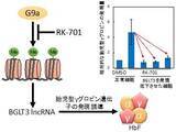 「【東京薬科大学】鎌状赤血球症の新しい治療薬候補を開発 -- ヒストンメチル化酵素G9aの新しい阻害剤RK-701 --」の画像3