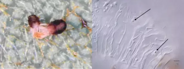「社会性のダニが集団で捕食者を排除する～ 巣網への刺激が誘発する「ご近所パトロール」 ～」の画像