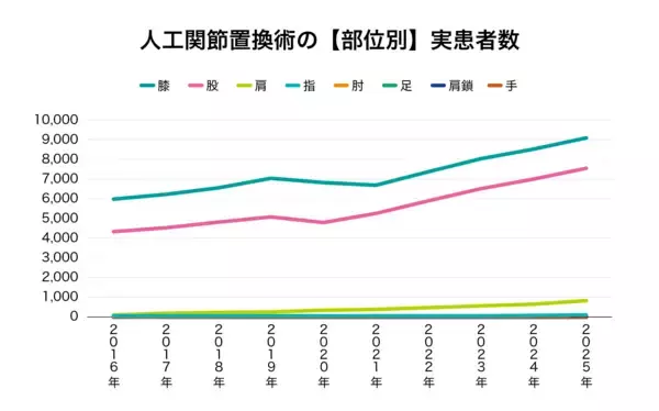 「人工関節置換術、年々手術数が増加、膝は10年で1.5倍に　医療ビッグデータで明らかに」の画像