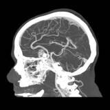 「シーメンスヘルスケア、フォトンカウンティングCT「NAEOTOM Alpha」を名古屋市立大学病院へ導入。最新デュアルソースの特性を活かした高精度な診断で地域医療へ貢献を目指す。」の画像2
