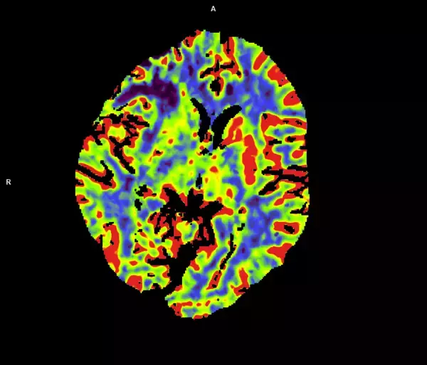 「シーメンスヘルスケア、フォトンカウンティングCT「NAEOTOM Alpha」を名古屋市立大学病院へ導入。最新デュアルソースの特性を活かした高精度な診断で地域医療へ貢献を目指す。」の画像