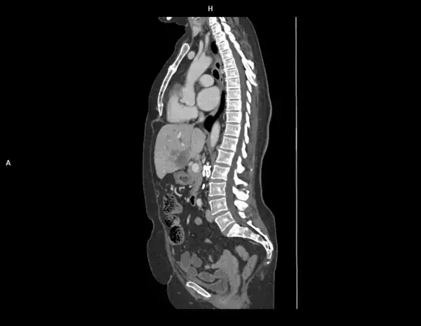 「シーメンスヘルスケア、フォトンカウンティングCT「NAEOTOM Alpha」を名古屋市立大学病院へ導入。最新デュアルソースの特性を活かした高精度な診断で地域医療へ貢献を目指す。」の画像