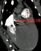 【日本大学】小型犬の心奇形、320列CTで「見える化」に成功～診断精度を飛躍させる新手法を実証～