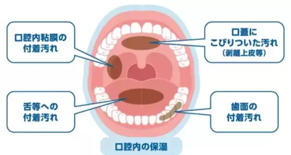 「MA-Tシステム(R)を活用した医科歯科向け口腔ケア用品『N.act オーラルリムーバルジェル』 新発売　高齢者にはケア負担の大きい付着汚れを除去しやすく！」の画像