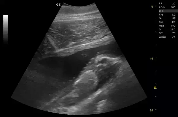 「【京都水族館】ハンドウイルカ「テン」妊娠のお知らせ」の画像