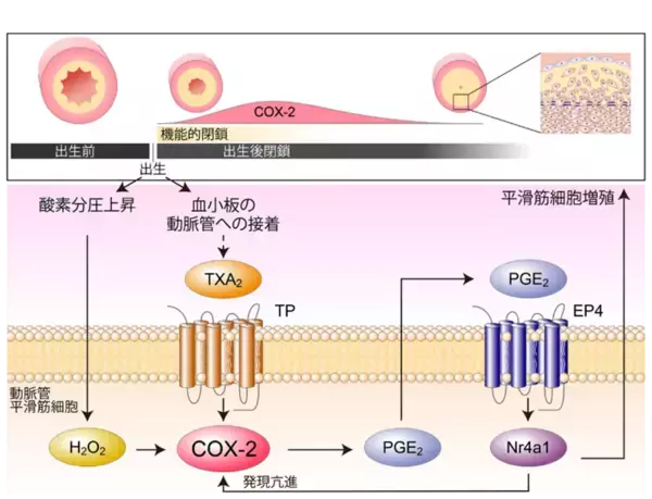 【東京医科大学】動脈管開存症に対するシクロオキシゲナーゼ阻害薬の投与タイミングに新たな科学的根拠 ～出生後のCOX-2増加が動脈管の解剖学的閉鎖を促進～