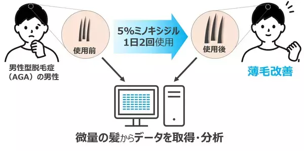 「世界で初の発見！ミノキシジルの「発毛スイッチの痕跡」【大正製薬】」の画像