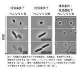 「大腸菌L-formにおいて、隔壁合成はアメーバ様細胞から一定の大きさの球形細胞への変化に必要である〜進化の過程で細胞形態がどのように決められたかの考察〜」の画像1