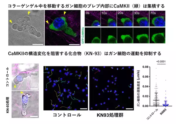 「【横浜市立大学】がん細胞の遊走に関わるブレブの形成機構の解明」の画像