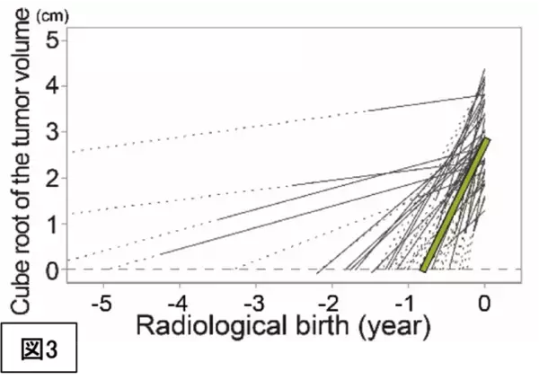 「膠芽腫の画像起源の解明～いつから腫瘍は存在していたのか？～（北里大学）」の画像