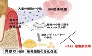 【日本大学】歯周病の増悪にウイルスが関与か