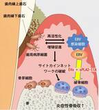 「【日本大学】歯周病の増悪にウイルスが関与か」の画像7