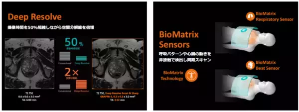 「シーメンスヘルスケア、被検者の検査体験を向上しながら高精度な検査を提供する1.5T MRI装置の最上位機種「MAGNETOM Flow.Elite」を発売」の画像