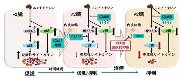【横浜市立大学】重症敗血症の原因に新たな鍵 治療標的となる分子 コクサッキーアデノウイルス受容体を発見