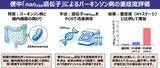 「パーキンソン病の進行度を便から推定する腸内細菌遺伝子マーカーを世界で初めて発見」の画像1