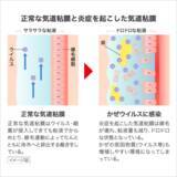 「受験ピーク！かぜ対策に、“早めのパブロン”！家庭の常備薬「パブロンSゴールドW」をご紹介」の画像5