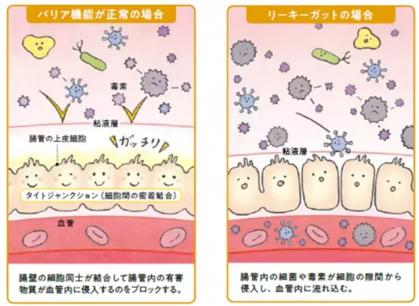 短鎖脂肪酸で腸内環境を整える ~免疫力向上のススメ~