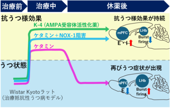 【横浜市立大学】ケタミンの抗うつ様効果を“持続”させる新戦略を発見