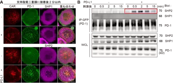 「【東京医科大学】PD-1によるCAR-T細胞抑制機構を解明 〜CAR-T細胞療法の免疫チェックポイント阻害療法との併用に期待〜」の画像