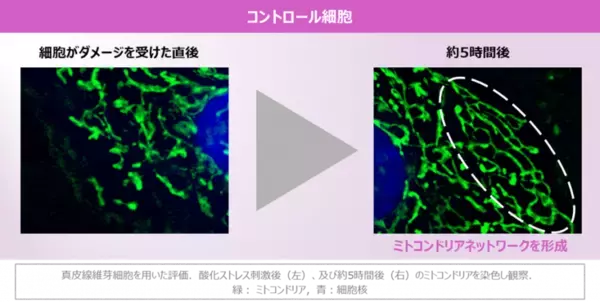 「ミトコンドリア研究で新事実」の画像
