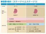 「【あなたの腎臓疾患の状態を知る】透析を準備する：慢性腎臓病（CKD）ステージ4～5のときに気をつけること」の画像1