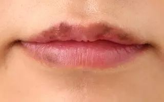 乾燥シーズン 要注意 女性の8割以上が くちびる萎え を経験 唇を無意識になめる 荒れた唇に口紅が引っかかる その唇をチェックリスト10項目で判断 18年11月19日 エキサイトニュース 乾燥シーズン 要注意 女性の8割以上が くちびる萎え を経験 唇を無意識になめる 荒れた唇に口紅が引っかかる その唇をチェックリスト10項目で判断 18年11月19日 エキサイトニュース