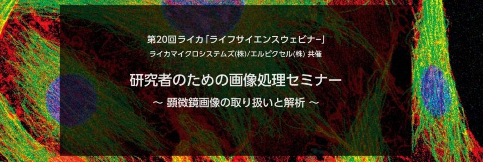 無料ウェビナー研究者のための画像処理 解析セミナー 顕微鏡画像の取扱いと解析 を開催 顕微鏡のライカマイクロシステムズ 2017年7月10日 エキサイトニュース