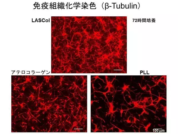 学校法人近畿大学、学校法人藍野大学と公益財団法人神戸医療産業都市推進機構の共同研究 -- 「神経細胞培養材および神経損傷治療剤」に関する国際特許の公開について --