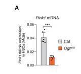 「造血幹細胞の維持に重要な酵素を発見　〜白血病治療などへの応用に期待〜」の画像4